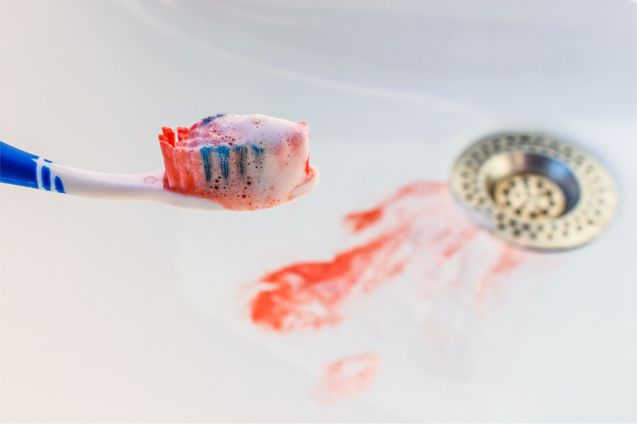 A bloody toothbrush over a bloody sink from bleeding gums due to gum disease in Bellevue