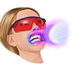 graphic illustration of a woman receiving teeth whitening