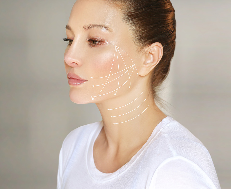 woman with thread lifts diagram on face